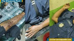 মহেশখালীতে ডাকাতের গুলিতে ৩ পুলিশ সদস্য আহত