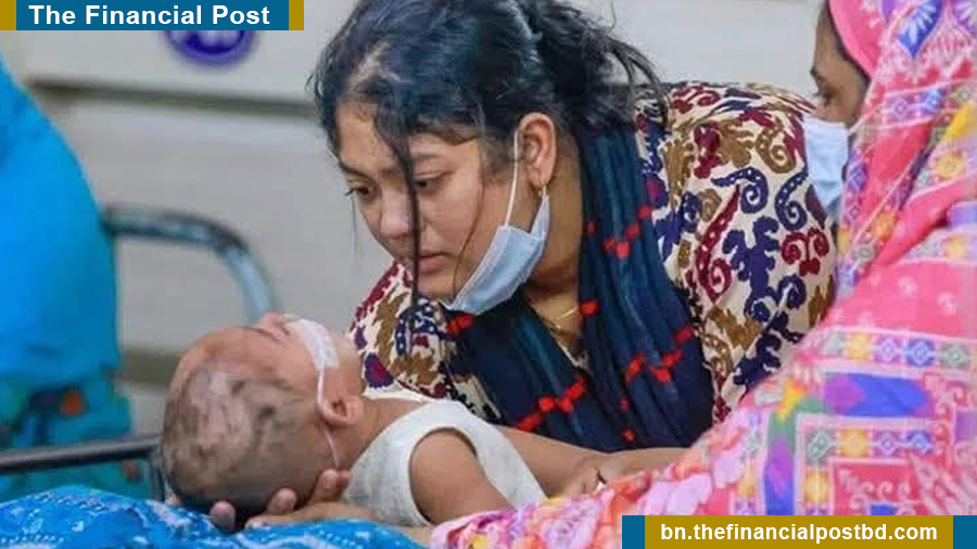 হাম ও হামের উপসর্গ নিয়ে আরও ১১ শিশুর মৃত্যু
