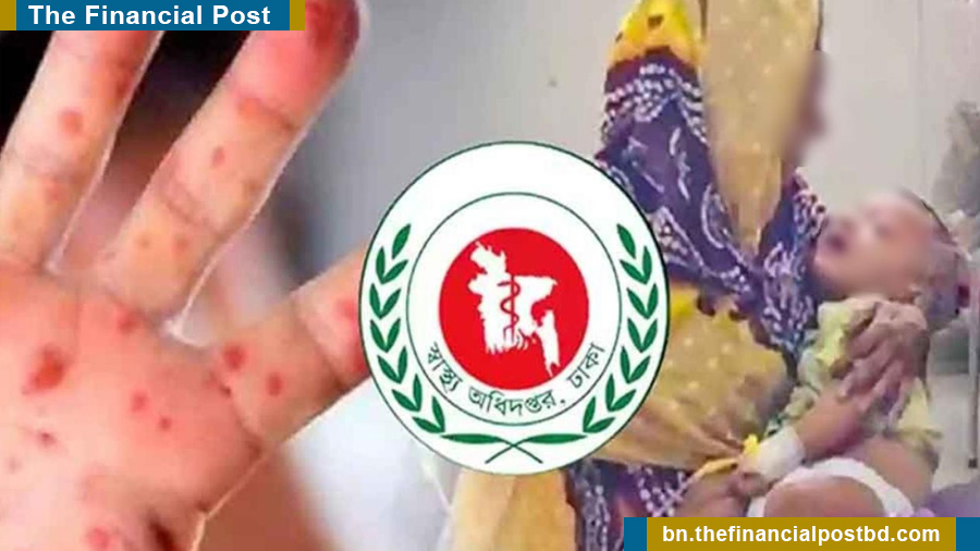 ২৪ ঘণ্টায় হাম ও উপসর্গে আরও ৮ জনের মৃত্যু