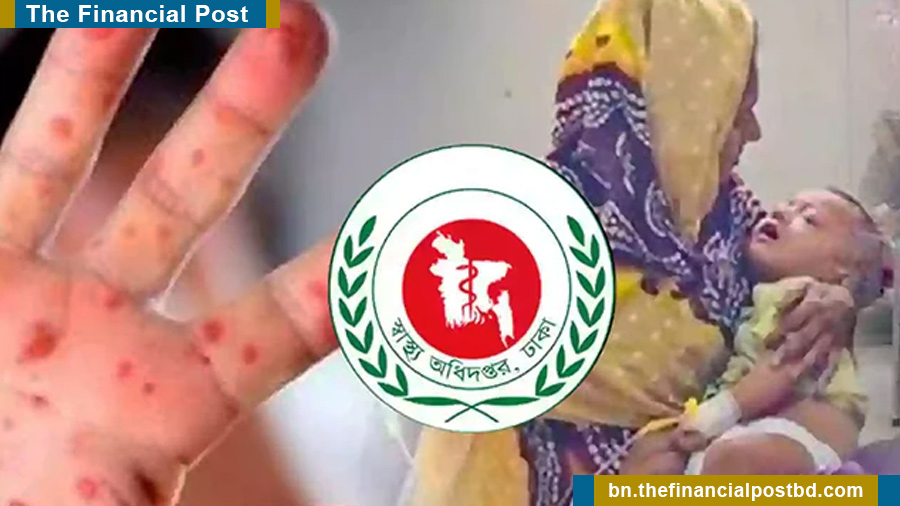 হাম ও হামের উপসর্গে আরও ৭ শিশুর মৃত্যু
