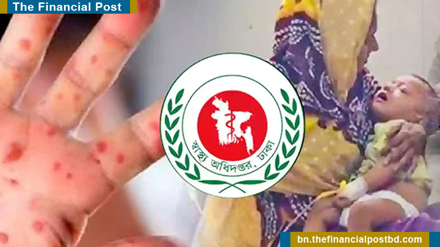 হাম ও হামের উপসর্গে আরও ৬ শিশুর মৃত্যু