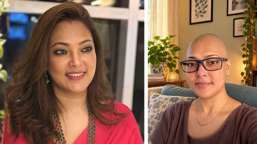 চুল ফেলার আগে ও পরে সামিয়া