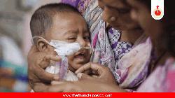 হামে আরও ৭ শিশুর মৃত্যু, মোট প্রাণহানি বেড়ে ১ হাজার ২১৪